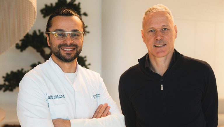 Marco van Basten haartransplantatie